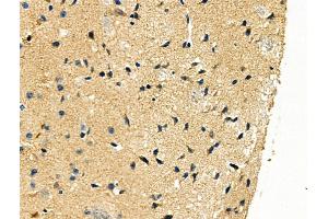 ABIN6262442 and ABIN6276447 at 1/100 staining Mouse brain tissue by IHC-P.