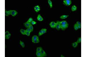 Immunofluorescence staining of HepG2 cells with ABIN7173829 at 1:200, counter-stained with DAPI. (TNFRSF1B 抗体  (AA 56-210))