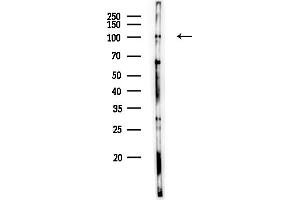 anti-5'-3' Exoribonuclease 2 (XRN2) (N-Term) antibody