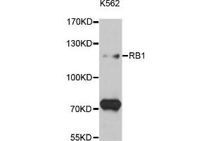 Western blot analysis of extracts of K-562 cells, using RB1 antibody (ABIN5995517) at 1:3000 dilution. (Retinoblastoma 1 抗体)
