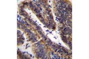 Immunohistochemistry analysis in formalin fixed and paraffin embedded human uterus tissue reacted with LRRN4CL Antibody (Center) followed which was peroxidase conjugated to the secondary antibody and followed by DAB staining. (LRRN4CL 抗体  (Middle Region))