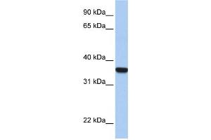 Western Blotting (WB) image for anti-Homeobox D1 (HOXD1) antibody (ABIN2457968)