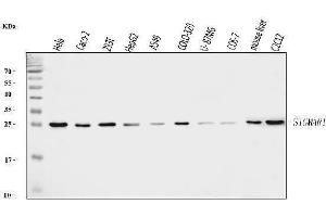 Western blot analysis of Sigma1-Receptor/SIGMAR1 using anti-Sigma1-Receptor/SIGMAR1 antibody (ABIN7599011).