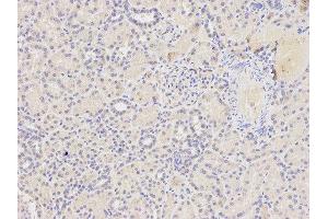 Immunohistochemistry of paraffin-embedded human kidney using FAS antibody at dilution of 1:400 (200x lens). (FAS 抗体)