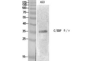 Western Blot (WB) analysis of specific cells using C/EBP epsilon Polyclonal Antibody. (CEBPE 抗体  (Ser2448))