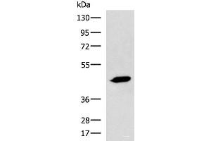 Western blot analysis of A431 cell lysate using ASB10 Polyclonal Antibody at dilution of 1:800 (ASB10 抗体)