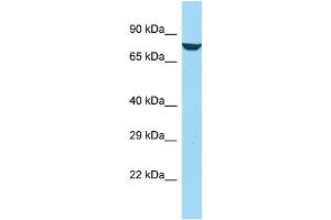 Host: Rabbit Target Name: AFAP1L1 Sample Type: Jurkat Whole Cell lysates Antibody Dilution: 1. (AFAP1L1 抗体  (C-Term))