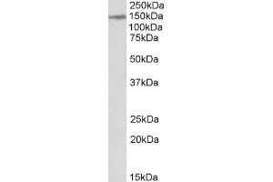 ABIN2563702 (2µg/ml) staining of Human Cerebellum lysate (35µg protein in RIPA buffer). (LMTK2 抗体  (Internal Region))