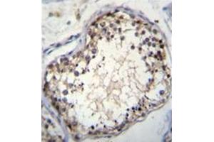 Immunohistochemistry analysis in formalin fixed and paraffin embedded human testis tissue reacted with OVOS Antibody (N-term) Cat. (OVOS1 (AA 57-87), (N-Term) 抗体)