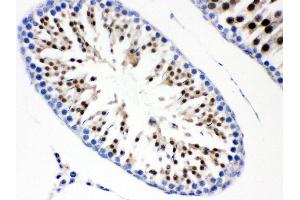 Immunohistochemistry (Paraffin-embedded Sections) (IHC (p)) image for anti-Cell Division Cycle 6 Homolog (S. Cerevisiae) (CDC6) (AA 147-549) antibody (ABIN3043500) (CDC6 抗体  (AA 147-549))