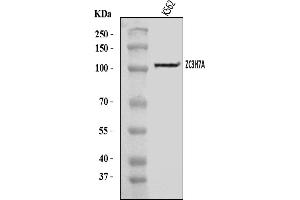 Western blot analysis of ZC3H7A using anti-ZC3H7A antibody (ABIN7599946).