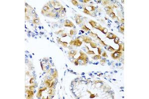 Immunohistochemistry of paraffin-embedded human stomach using CCL21 antibody. (CCL21 抗体)