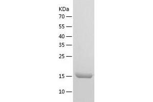 Western Blotting (WB) image for Hematological and Neurological Expressed 1-Like (HN1L) (AA 1-190) protein (His tag) (ABIN7288856) (HN1L Protein (AA 1-190) (His tag))