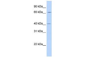 ASAP3 antibody used at 1 ug/ml to detect target protein. (ASAP3 抗体  (N-Term))