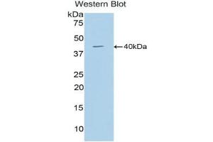 Western Blotting (WB) image for anti-Cathepsin D (CTSD) (AA 66-410) antibody (ABIN3206938) (Cathepsin D 抗体  (AA 66-410))