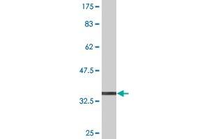 Western Blot detection against Immunogen (36. (DYRK4 抗体  (AA 421-520))