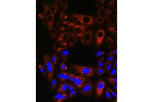 Immunofluorescence analysis of U-2 OS cells using HSPB8/HSP22 Rabbit mAb (ABIN6132943, ABIN6144482, ABIN6144483 and ABIN7101424) at dilution of 1:100 (40x lens). (HSPB8 抗体)