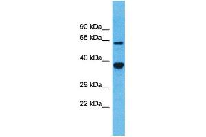 Western Blotting (WB) image for anti-Olfactory Receptor, Family 5, Subfamily D, Member 13 (OR5D13) (C-Term) antibody (ABIN2791752)