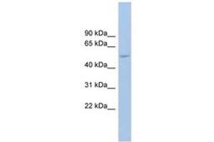 Image no. 1 for anti-Ankyrin Repeat Domain 13 Family, Member D (ANKRD13D) (AA 518-567) antibody (ABIN6745108) (ANKRD13D 抗体  (AA 518-567))