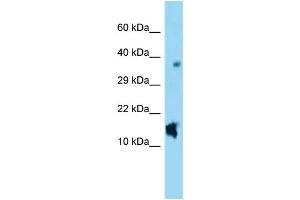 WB Suggested Anti-Nppc Antibody Titration: 1. (NPPC 抗体  (C-Term))