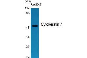Western Blot (WB) analysis of specific cells using Cytokeratin 7 Polyclonal Antibody. (Cytokeratin 7 抗体  (C-Term))