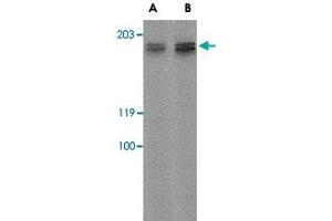 Western blot analysis of GPR124 in rat kidney tissue lysate with GPR124 polyclonal antibody  at (A) 2 ug/mL and (B) 4 ug/mL . (GPR124 抗体  (Internal Region))