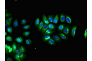 Immunofluorescent analysis of A549 cells using ABIN7158320 at dilution of 1:100 and Alexa Fluor 488-congugated AffiniPure Goat Anti-Rabbit IgG(H+L) (LHFPL5 抗体  (AA 46-99))