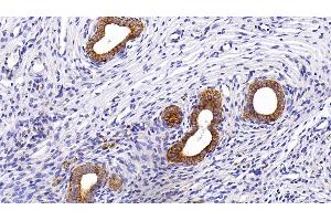 Detection of CK5 in Rat Uterus Tissue using Polyclonal Antibody to Cytokeratin 5 (CK5) (Cytokeratin 5 抗体  (AA 335-473))