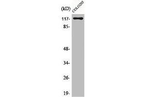 Western Blot analysis of COLO205 cells using C/EBP ζ Polyclonal Antibody (CEBPZ 抗体  (N-Term))