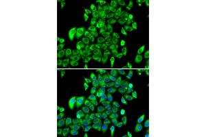 Immunofluorescence analysis of MCF7 cell using RPL13 antibody. (RPL13 抗体)