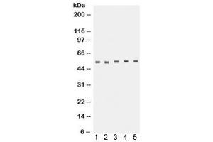 Western blot testing of 1) human placenta, 2) rat lung, 3) rat brain, 4) U87 and 5) A431 lysate with TACR1 antibody. (TACR1 抗体)