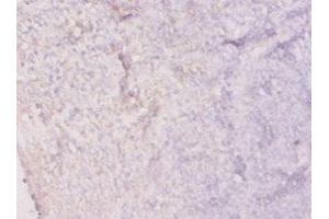 Immunohistochemistry of paraffin-embedded human tonsil tissue using ABIN7156020 at dilution of 1:20 (HPRT1 抗体  (AA 2-218))