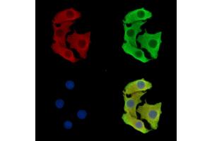 ABIN7097067 and ABIN7101134 staining Hela cells by IF/ICC. (TMEM63C 抗体)