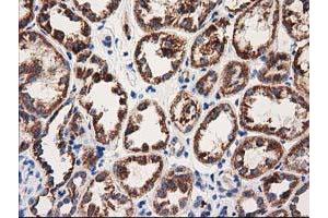 Immunohistochemical staining of paraffin-embedded Human Kidney tissue using anti-MMAA mouse monoclonal antibody. (MMAA 抗体)