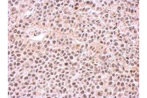 IHC-P Image Immunohistochemical analysis of paraffin-embedded HeLa xenograft, using PSMC6, antibody at 1:500 dilution. (PSMC6 抗体)