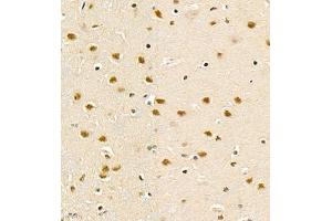 Immunohistochemistry of paraffin embedded rat brain using PHF10 (ABIN7075029) at dilution of 1:1200 (400x lens) (PHF10 抗体)