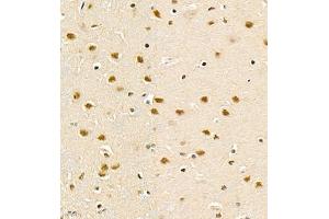Immunohistochemistry of paraffin embedded rat brain using PHF10 (ABIN7075029) at dilution of 1:1200 (400x lens) (PHF10 抗体)