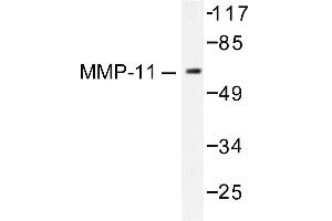 Image no. 1 for anti-Matrix Metallopeptidase 11 (Stromelysin 3) (MMP11) antibody (ABIN265523) (MMP11 抗体)
