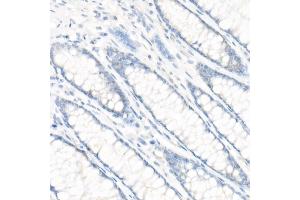 Immunohistochemistry of paraffin-embedded Human colon (negative control sample) using CD147/BSG antibody (ABIN7265838) at dilution of 1:100 (40x lens). (CD147 抗体)