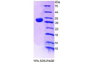 SDS-PAGE analysis of Human CNP Protein. (Cnpase 蛋白)