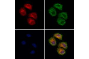 ABIN7094629 and ABIN7098679 staining Hela cells by IF/ICC. (TOM1L2 抗体  (Internal Region))