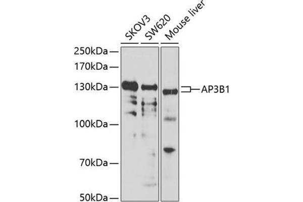 AP3B1 抗体  (AA 895-1094)
