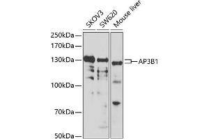 Western blot analysis of extracts of various cell lines, using B1 antibody (ABIN6129916, ABIN6136962, ABIN6136963 and ABIN6222795) at 1:1000 dilution. (AP3B1 抗体  (AA 895-1094))