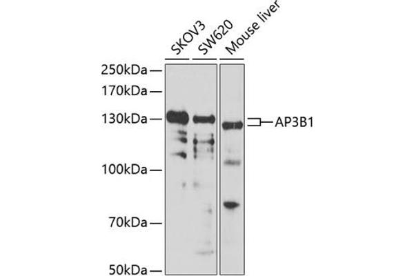AP3B1 antibody  (AA 895-1094)