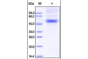 SDS-PAGE (SDS) image for Interleukin 5 Receptor, alpha (IL5RA) (AA 21-335) protein (His tag) (ABIN2181392)