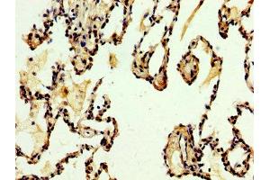 IHC image of ABIN7149882 diluted at 1:500 and staining in paraffin-embedded human lung tissue performed on a Leica BondTM system. (DKK2 抗体  (AA 34-259))