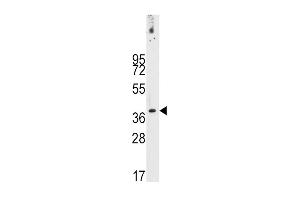 Western blot analysis of anti-PDX1 Antibody (T11) (ABIN388774 and ABIN2839109) in NCI- cell line lysates (35 μg/lane). (PDX1 抗体  (AA 1-30))