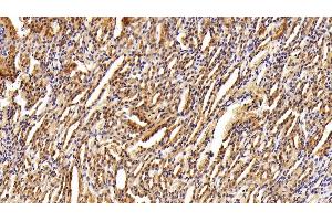 Immunohistochemistry (IHC) image for anti-Lectin, Galactoside-Binding, Soluble, 8 (LGALS8) (AA 1-317) antibody (ABIN7431593)