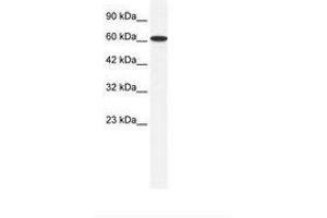Image no. 1 for anti-Zinc Finger Protein 266 (ZNF266) (AA 27-76) antibody (ABIN6735986) (ZNF266 抗体  (AA 27-76))