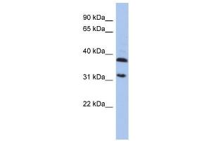 ASPA antibody used at 1 ug/ml to detect target protein. (ASPA 抗体)
